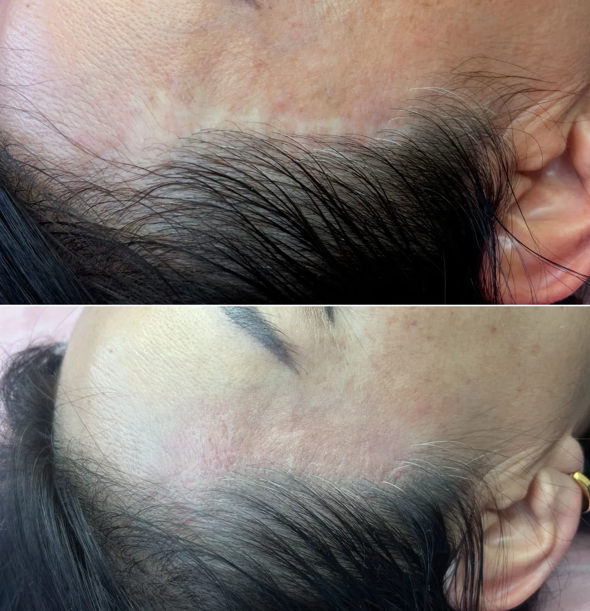 Skin Condition Treatment Before and After
